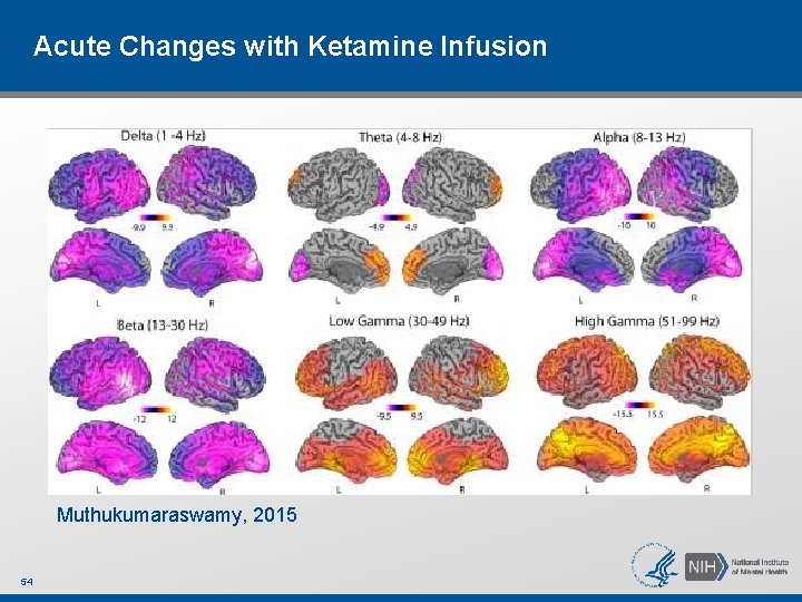 Acute Changes with Ketamine Infusion Muthukumaraswamy, 2015 54 Acute Changes with Ketamine Infusion Muthukumaraswamy, 2015 54
