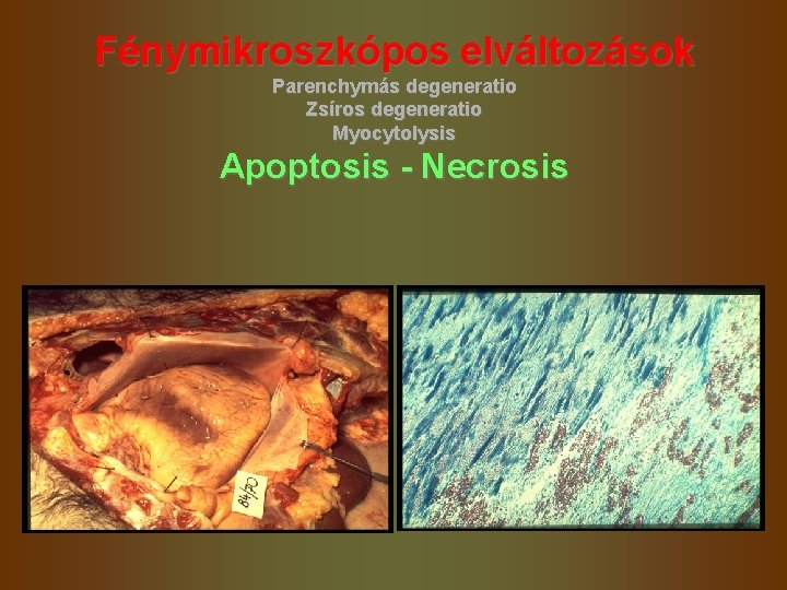 Fénymikroszkópos elváltozások Parenchymás degeneratio Zsíros degeneratio Myocytolysis Apoptosis - Necrosis Fénymikroszkópos elváltozások Parenchymás degeneratio Zsíros degeneratio Myocytolysis Apoptosis - Necrosis