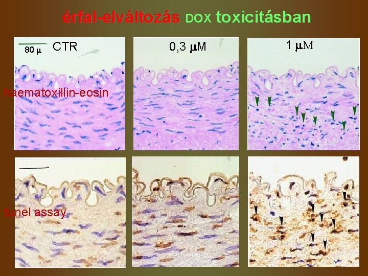 érfal-elváltozás DOX toxicitásban 80 m CTR haematoxillin-eosin tunel assay 0, 3 m. M 1