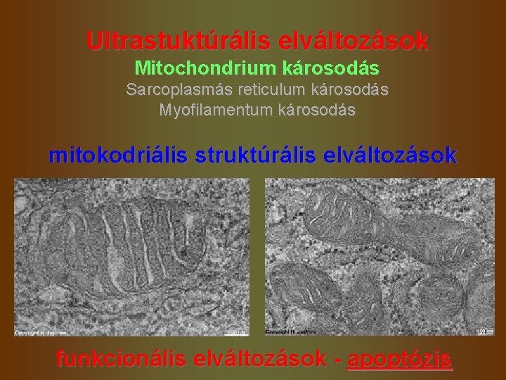 Ultrastuktúrális elváltozások Mitochondrium károsodás Sarcoplasmás reticulum károsodás Myofilamentum károsodás mitokodriális struktúrális elváltozások funkcionális elváltozások