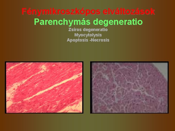 Fénymikroszkópos elváltozások Parenchymás degeneratio Zsíros degeneratio Myocytolysis Apoptosis -Necrosis Fénymikroszkópos elváltozások Parenchymás degeneratio Zsíros degeneratio Myocytolysis Apoptosis -Necrosis