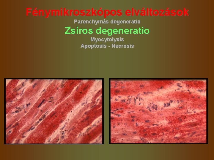 Fénymikroszkópos elváltozások Parenchymás degeneratio Zsíros degeneratio Myocytolysis Apoptosis - Necrosis 