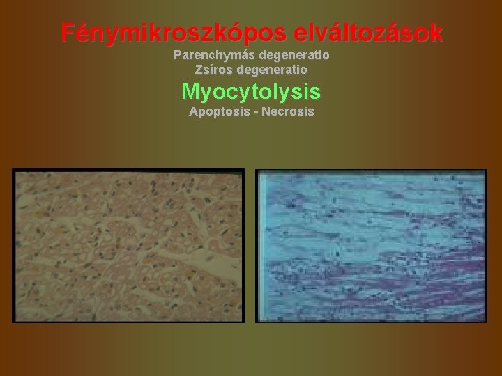 Fénymikroszkópos elváltozások Parenchymás degeneratio Zsíros degeneratio Myocytolysis Apoptosis - Necrosis 