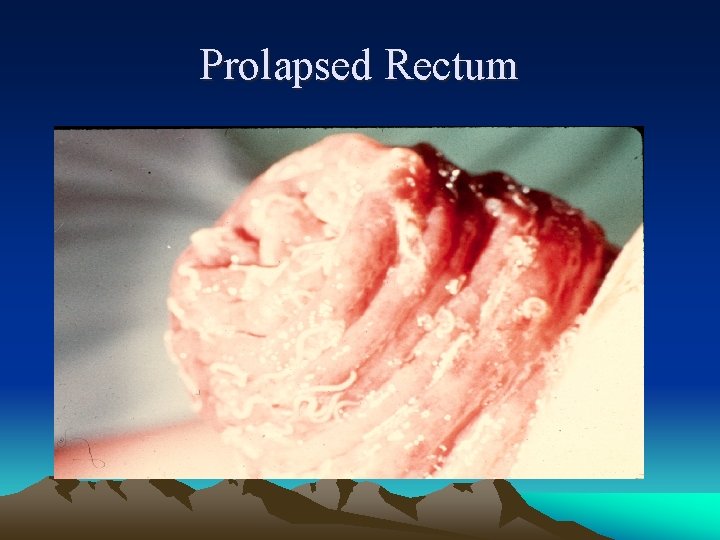 Prolapsed Rectum 