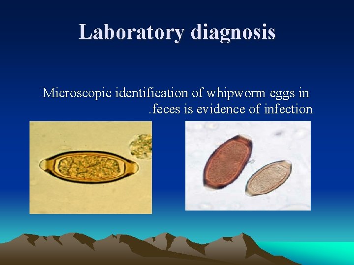 Laboratory diagnosis Microscopic identification of whipworm eggs in. feces is evidence of infection 
