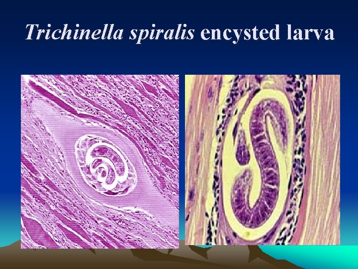 Trichinella spiralis encysted larva 