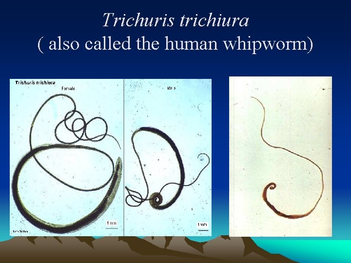 Trichuris trichiura ( also called the human whipworm) 
