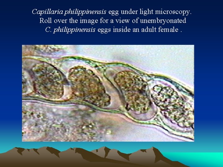 Capillaria philippinensis egg under light microscopy. Roll over the image for a view of