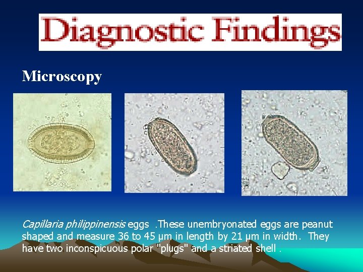 Microscopy Capillaria philippinensis eggs. These unembryonated eggs are peanut shaped and measure 36 to
