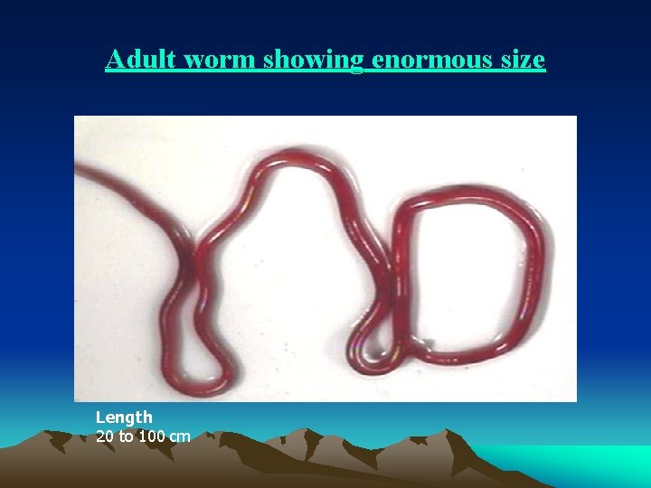 Adult worm showing enormous size Length 20 to 100 cm 