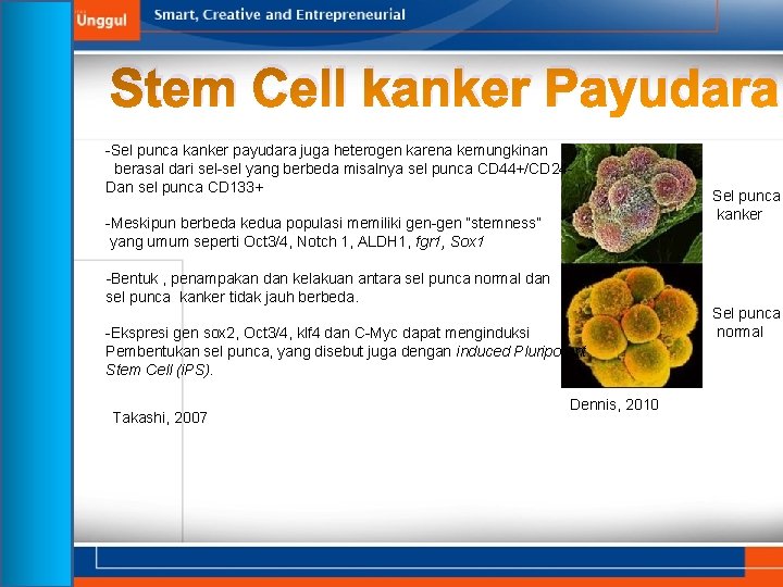 Stem Cell kanker Payudara -Sel punca kanker payudara juga heterogen karena kemungkinan berasal dari