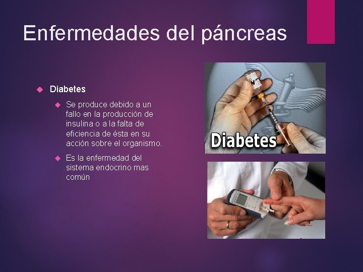 Enfermedades del páncreas Diabetes Se produce debido a un fallo en la producción de Enfermedades del páncreas Diabetes Se produce debido a un fallo en la producción de