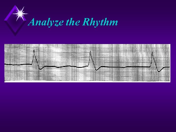 Analyze the Rhythm 