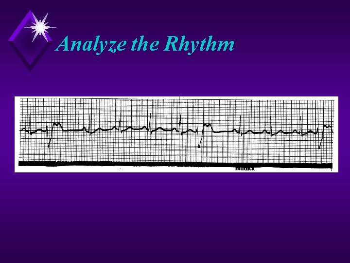 Analyze the Rhythm 