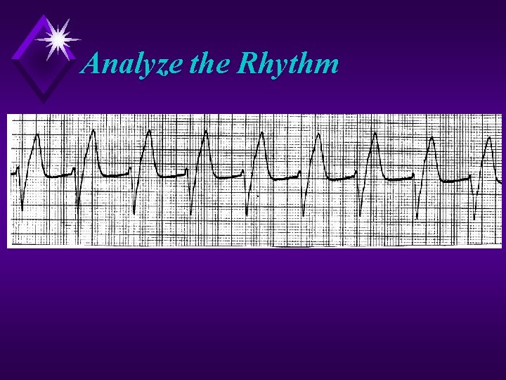 Analyze the Rhythm 