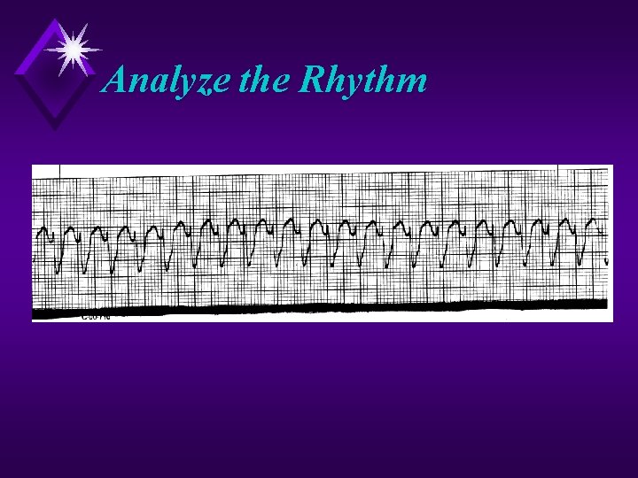 Analyze the Rhythm 