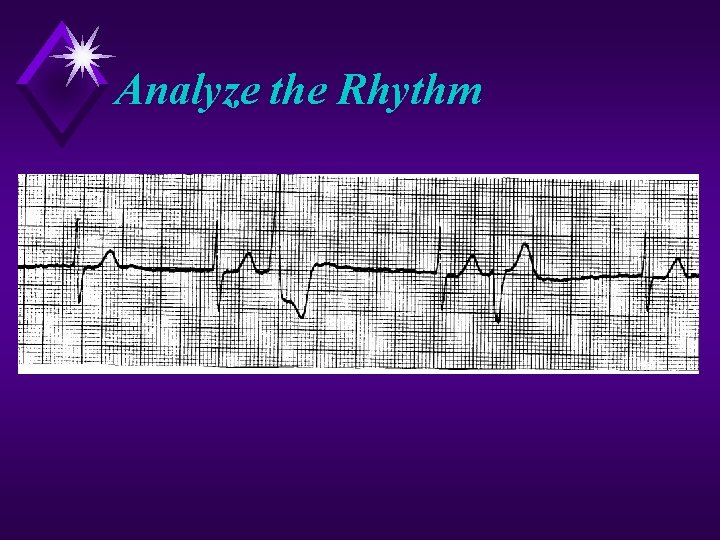 Analyze the Rhythm 