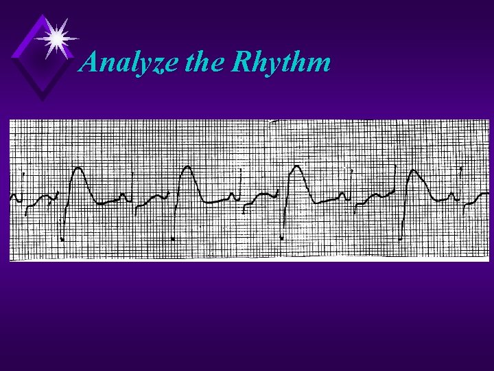 Analyze the Rhythm 