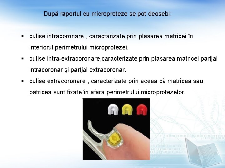 După raportul cu microproteze se pot deosebi: § culise intracoronare , caractarizate prin plasarea După raportul cu microproteze se pot deosebi: § culise intracoronare , caractarizate prin plasarea