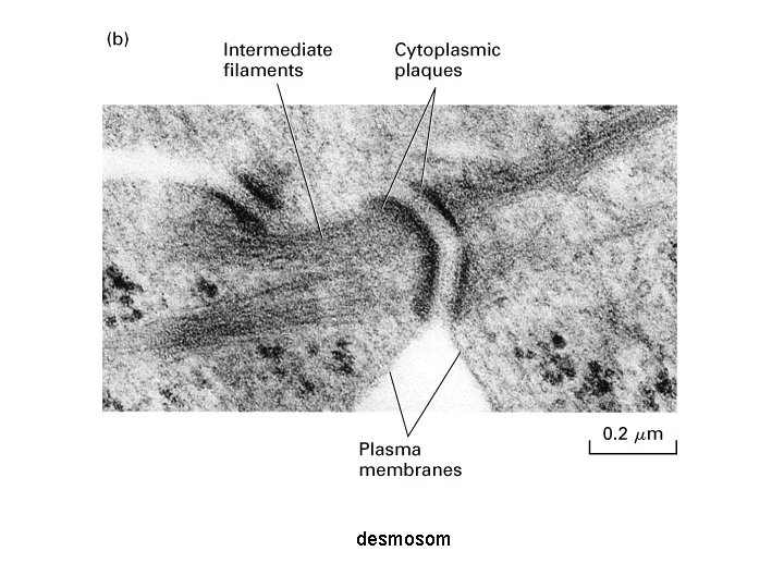 desmosom 