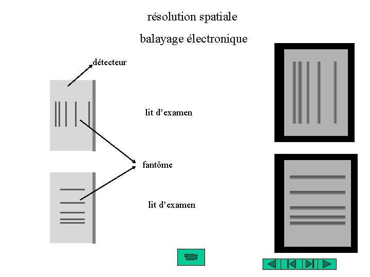 résolution spatiale balayage électronique détecteur lit d’examen fantôme lit d’examen 