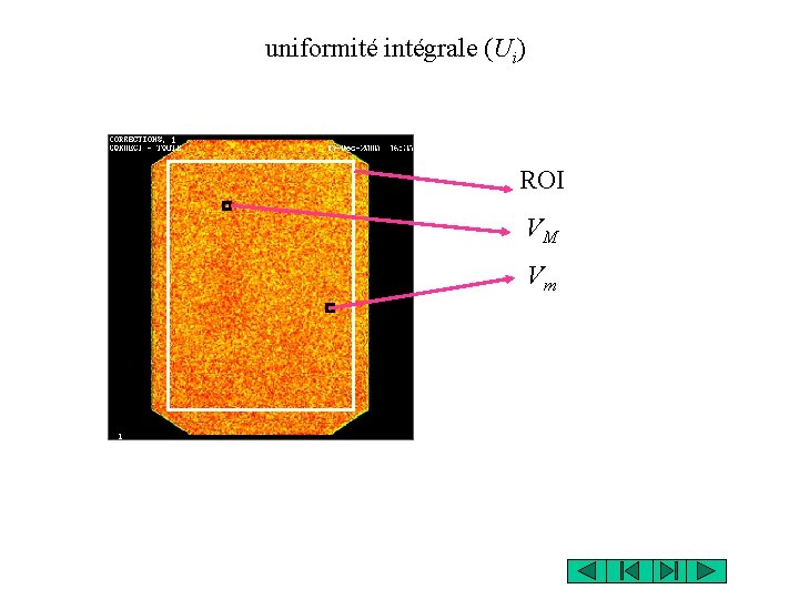 uniformité intégrale (Ui) ROI VM Vm 