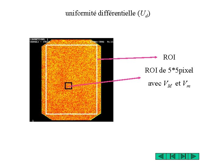 uniformité différentielle (Ud) ROI de 5*5 pixel avec VM et Vm 