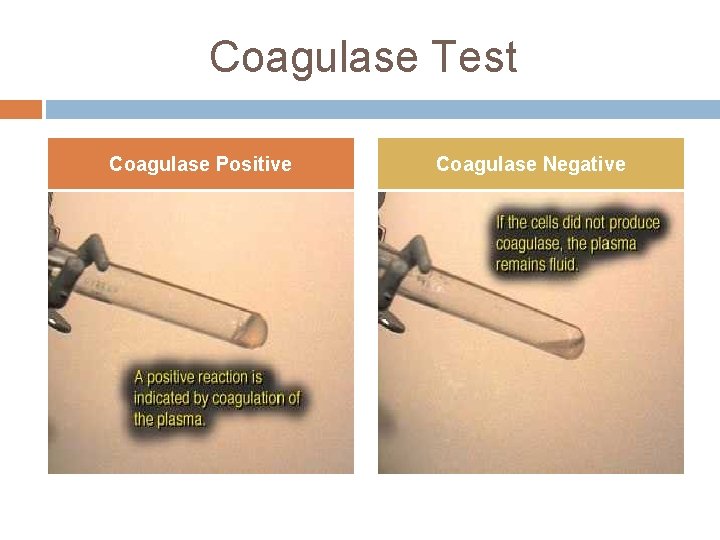 Coagulase Test Coagulase Positive Coagulase Negative Coagulase Test Coagulase Positive Coagulase Negative