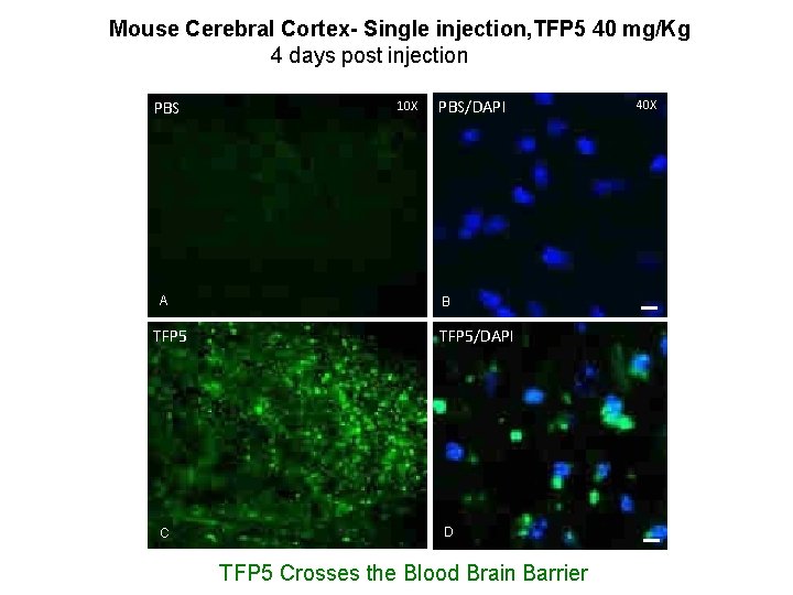 Mouse Cerebral Cortex- Single injection, TFP 5 40 mg/Kg 4 days post injection PBS