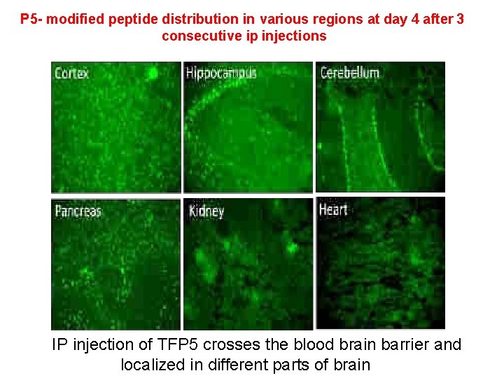 P 5 - modified peptide distribution in various regions at day 4 after 3