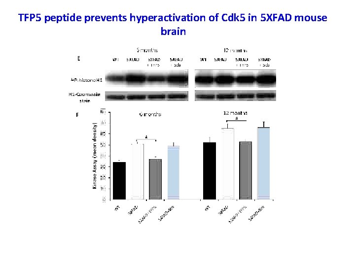 TFP 5 peptide prevents hyperactivation of Cdk 5 in 5 XFAD mouse brain 