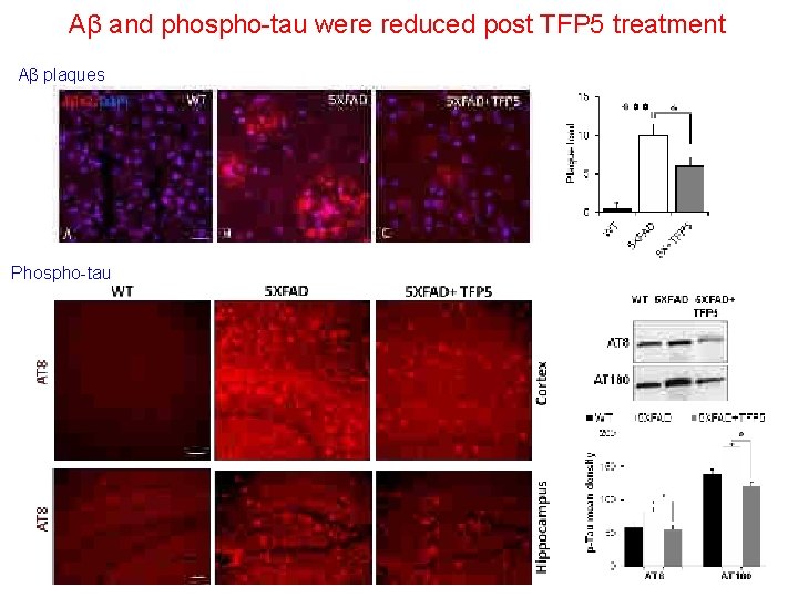 Aβ and phospho-tau were reduced post TFP 5 treatment Aβ plaques Phospho-tau 