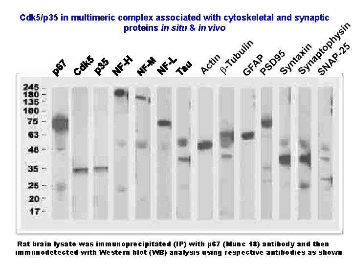 Cdk 5/p 35 in multimeric complex associated with cytoskeletal and synaptic proteins in situ