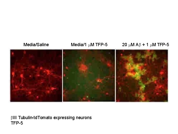 Media/Saline Media/1 M TFP-5 III Tubulin-td. Tomato expressing neurons TFP-5 20 M A +