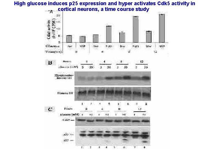 High glucose induces p 25 expression and hyper activates Cdk 5 activity in A