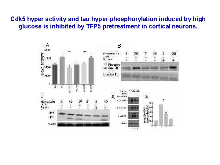 Cdk 5 hyper activity and tau hyper phosphorylation induced by high glucose is inhibited