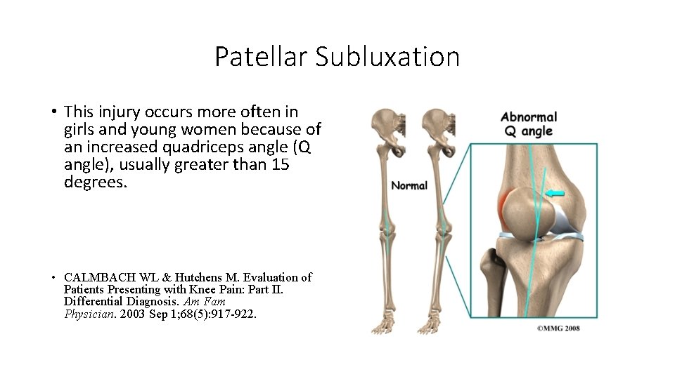 Patellar Subluxation • This injury occurs more often in girls and young women because