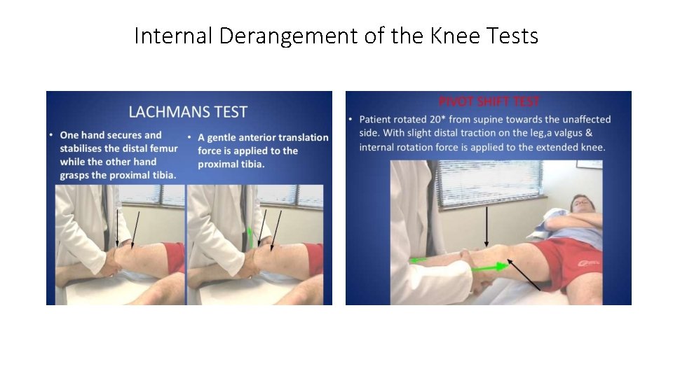 Internal Derangement of the Knee Tests 