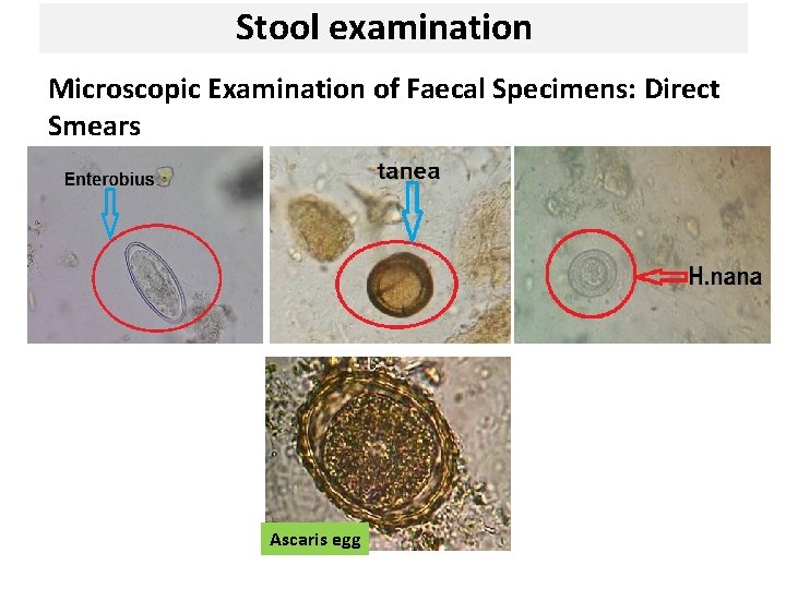 Stool examination Microscopic Examination of Faecal Specimens: Direct Smears Ascaris egg 