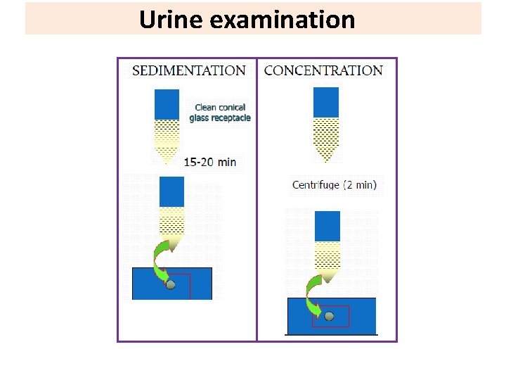 Urine examination 