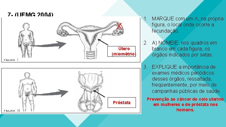 7 - (UFMG 2004) X Útero (miométrio) 1. MARQUE com um X, na própria