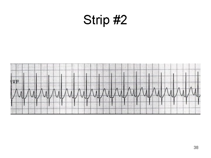 Strip #2 38 Strip #2 38