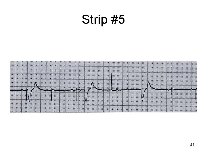 Strip #5 41 Strip #5 41