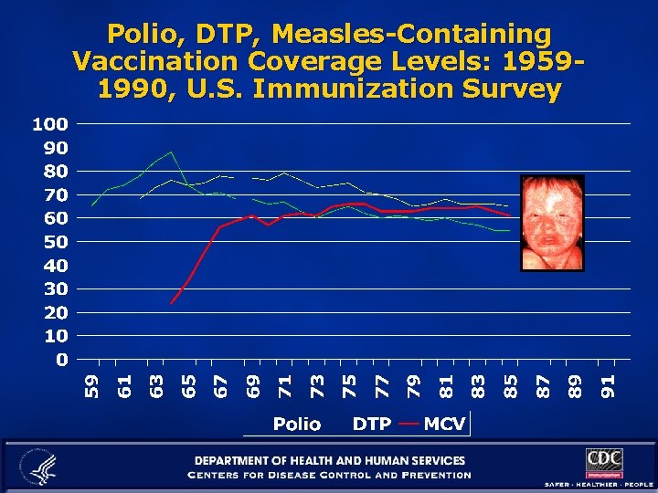 Polio, DTP, Measles-Containing Vaccination Coverage Levels: 19591990, U. S. Immunization Survey 