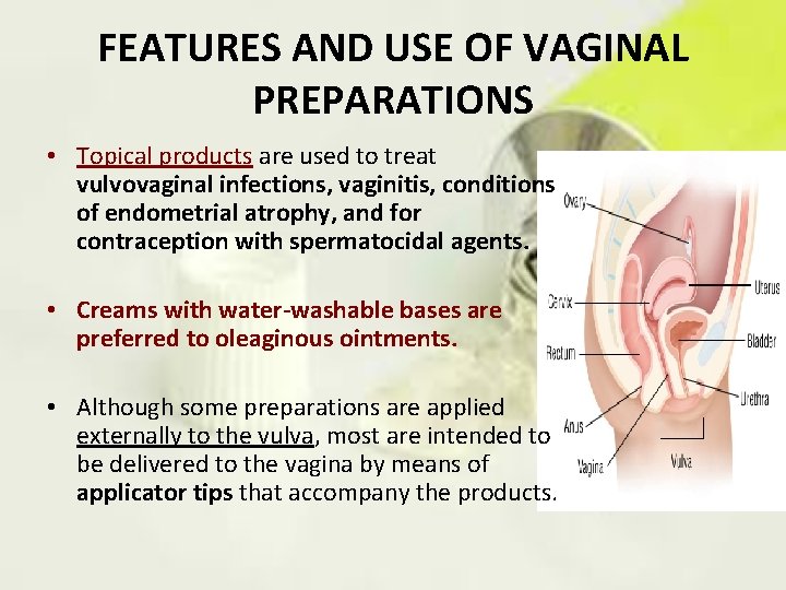 FEATURES AND USE OF VAGINAL PREPARATIONS • Topical products are used to treat vulvovaginal