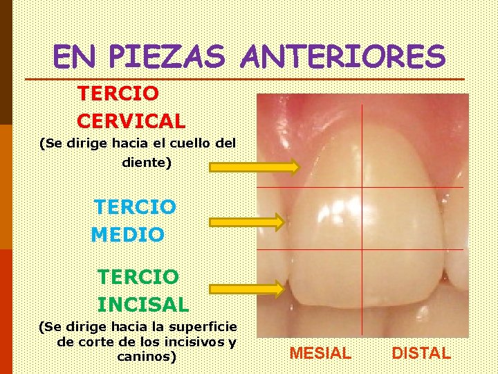EN PIEZAS ANTERIORES TERCIO CERVICAL (Se dirige hacia el cuello del diente) TERCIO MEDIO EN PIEZAS ANTERIORES TERCIO CERVICAL (Se dirige hacia el cuello del diente) TERCIO MEDIO