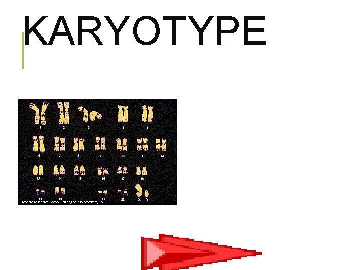 KARYOTYPE 