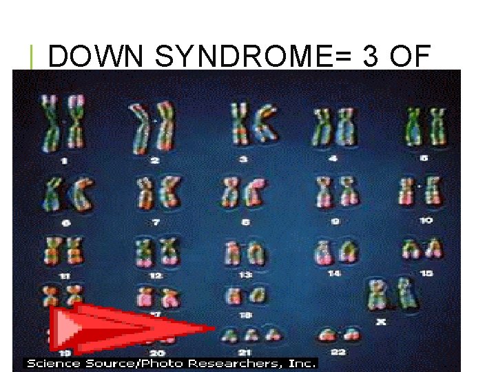 DOWN SYNDROME= 3 OF #21 