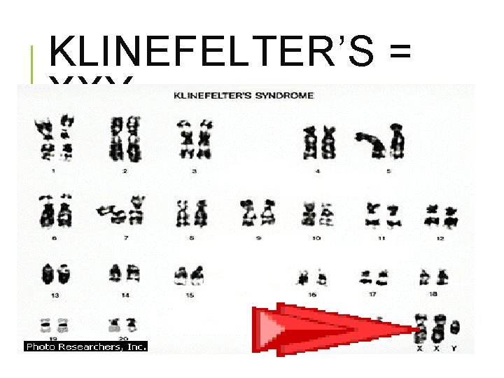 KLINEFELTER’S = XXY 