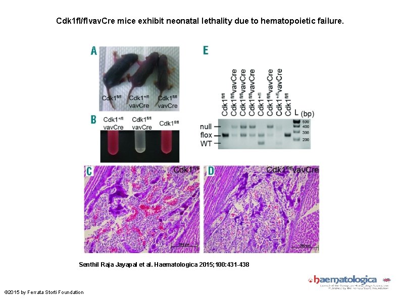 Cdk 1 fl/flvav. Cre mice exhibit neonatal lethality due to hematopoietic failure. Senthil Raja